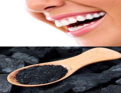 تبيض الأسنان بالفحم