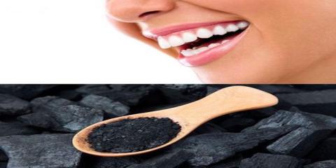 تبيض الأسنان بالفحم