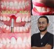 الدكتور/ أحمد عادل شعبان: جراحة زراعة الأسنان لم تعد مؤلمة، ولا تستغرق وقت طويل بدخول الأجهزة الرقمية